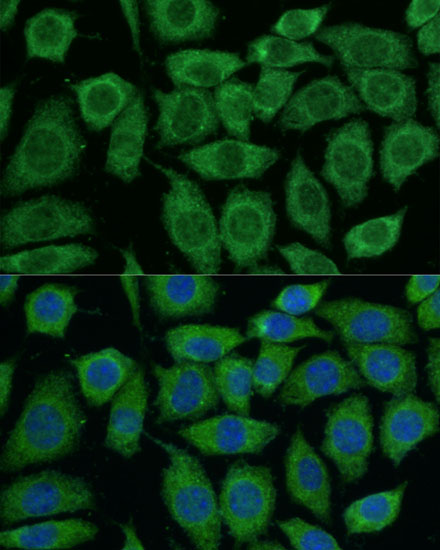 Immunofluorescence analysis of L929 cells using DLAT Polyclonal Antibody at dilution of  1:100. Blue: DAPI for nuclear staining.