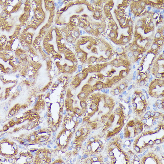 Immunohistochemistry of paraffin-embedded Mouse kidney using DLAT Polyclonal Antibody at dilution of  1:100 (40x lens).