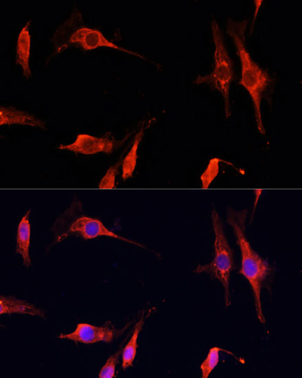 Immunofluorescence analysis of C6 cells using DNASE1 Polyclonal Antibody at dilution of  1:100 (40x lens). Blue: DAPI for nuclear staining.