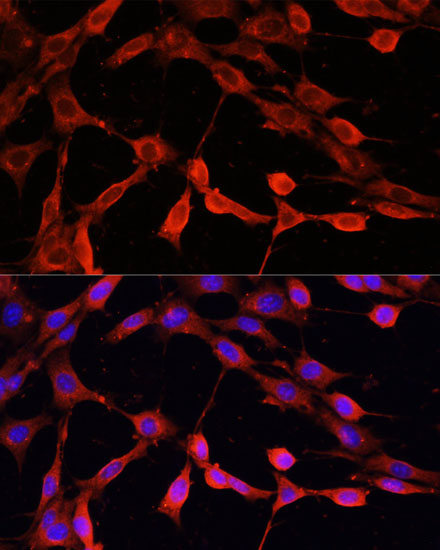 Immunofluorescence analysis of NIH-3T3 cells using DNASE1 Polyclonal Antibody at dilution of  1:100 (40x lens). Blue: DAPI for nuclear staining.