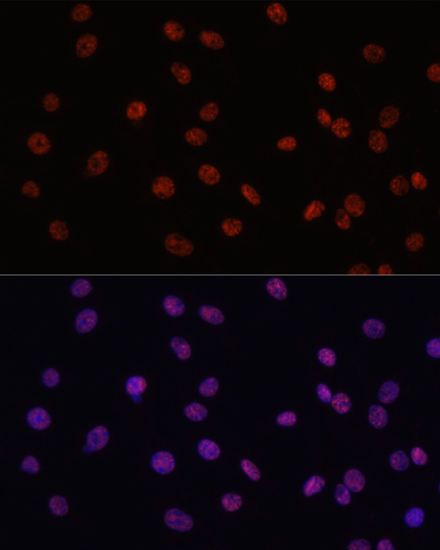 Immunofluorescence analysis of C6 cells using MYCT1 Polyclonal Antibody at dilution of  1:100. Blue: DAPI for nuclear staining.