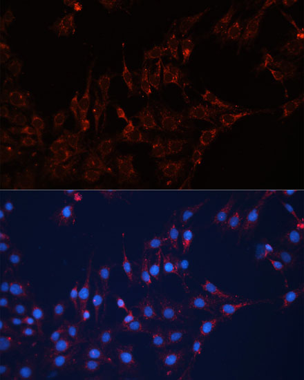Immunofluorescence analysis of C6 cells using GNAI2 Polyclonal Antibody at dilution of  1:100 (40x lens). Blue: DAPI for nuclear staining.