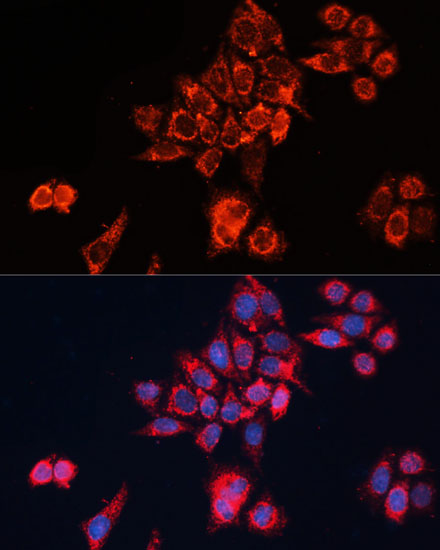 Immunofluorescence analysis of HeLa cells using GNAI2 Polyclonal Antibody at dilution of  1:100 (40x lens). Blue: DAPI for nuclear staining.