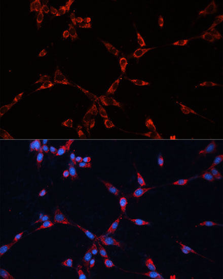 Immunofluorescence analysis of NIH-3T3 cells using GNAI2 Polyclonal Antibody at dilution of  1:100 (40x lens). Blue: DAPI for nuclear staining.