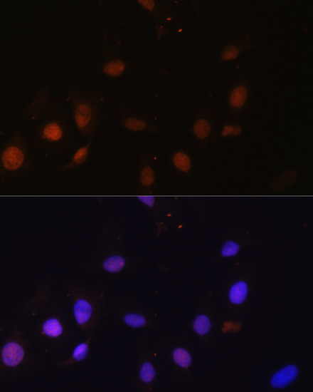Immunofluorescence analysis of U-2 OS cells using SNW1 Polyclonal Antibody at dilution of  1:100. Blue: DAPI for nuclear staining.