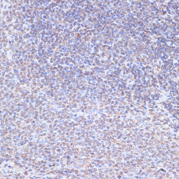 Immunohistochemistry of paraffin-embedded Rat spleen using SNW1 Polyclonal Antibody at dilution of  1:100 (40x lens).