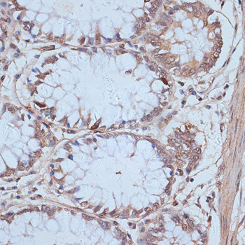 Immunohistochemistry of paraffin-embedded Human colon using SNW1 Polyclonal Antibody at dilution of  1:100 (40x lens).