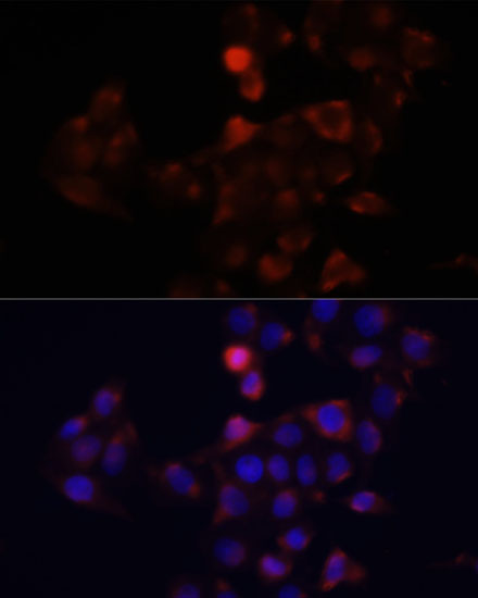 Immunofluorescence analysis of HeLa cells using DCX Polyclonal Antibody at dilution of  1:100. Blue: DAPI for nuclear staining.