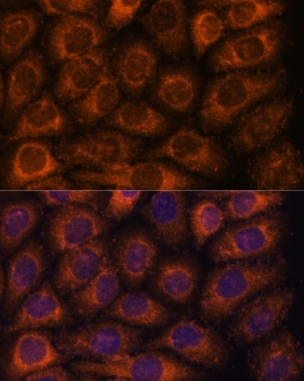Immunofluorescence analysis of HeLa cells using CCT6B Polyclonal Antibody at dilution of  1:100. Blue: DAPI for nuclear staining.