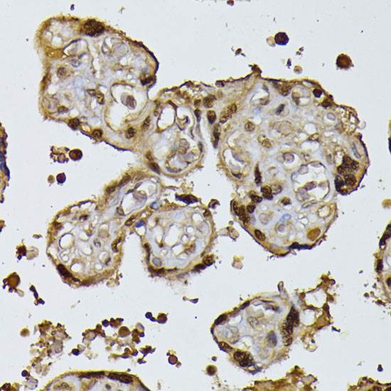 Immunohistochemistry of paraffin-embedded Human placenta using RPS27A Polyclonal Antibody at dilution of  1:100 (40x lens).