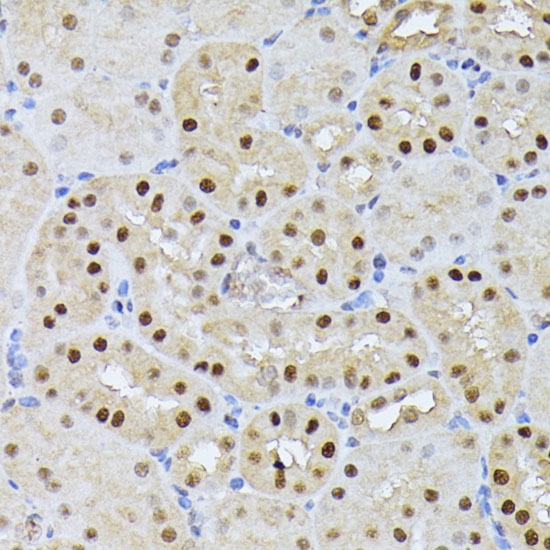 Immunohistochemistry of paraffin-embedded Mouse kidney using RPS27A Polyclonal Antibody at dilution of  1:100 (40x lens).