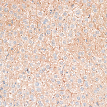 Immunohistochemistry of paraffin-embedded Mouse liver using CDH18 Polyclonal Antibody at dilution of  1:100 (40x lens).