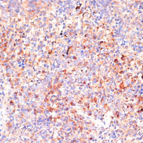 Immunohistochemistry of paraffin-embedded Mouse spleen using IL4R Polyclonal Antibody at dilution of  1:100 (40x lens).