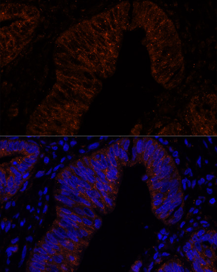 Immunofluorescence analysis of Human colon carcinoma cells using MUC2 Polyclonal Antibody at dilution of  1:100. Blue: DAPI for nuclear staining.