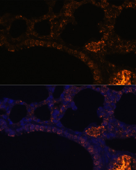 Immunofluorescence analysis of Rat lung cells using MUC2 Polyclonal Antibody at dilution of  1:100. Blue: DAPI for nuclear staining.