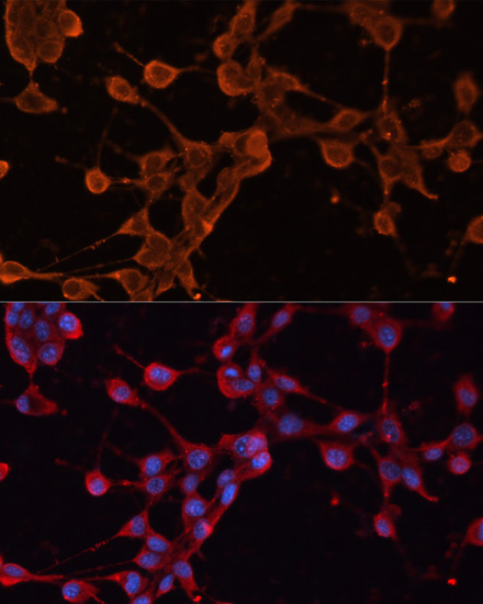 Immunofluorescence analysis of NIH/3T3 cells using ABCB11 Polyclonal Antibody at dilution of  1:100. Blue: DAPI for nuclear staining.