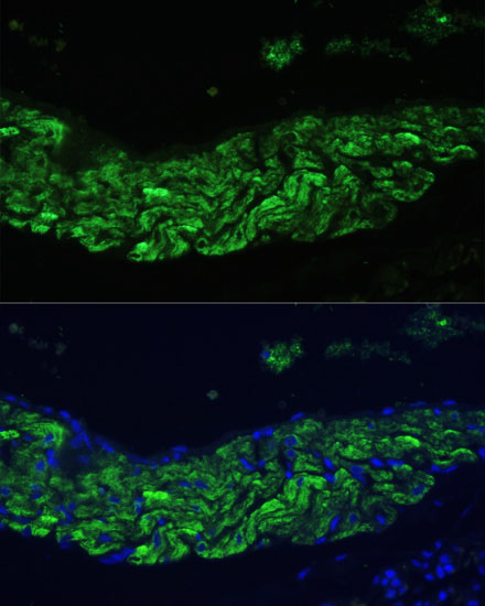 Immunofluorescence analysis of Rat lung using ALOX12 Polyclonal Antibody at dilution of  1:100 (40x lens). Blue: DAPI for nuclear staining.