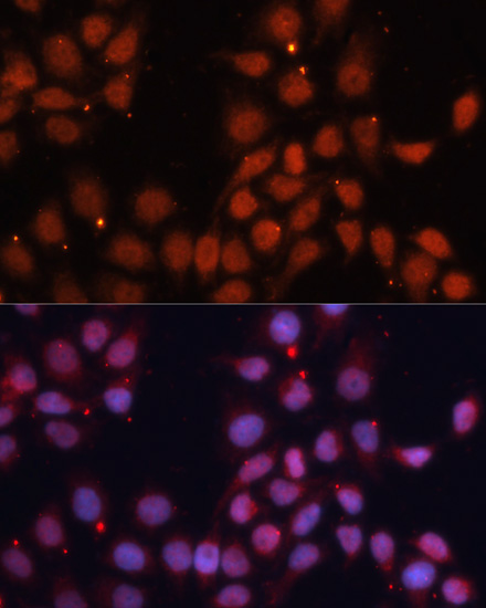 Immunofluorescence analysis of HeLa cells using CDK11B Polyclonal Antibody at dilution of  1:100. Blue: DAPI for nuclear staining.