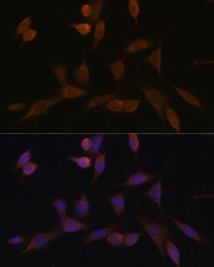 Immunofluorescence analysis of NIH-3T3 cells using NDUFA5 Polyclonal Antibody at dilution of  1:100 (40x lens). Blue: DAPI for nuclear staining.