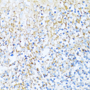 Immunohistochemistry of paraffin-embedded Human tonsil using NDUFA5 Polyclonal Antibody at dilution of  1:100 (40x lens).