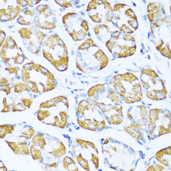 Immunohistochemistry of paraffin-embedded Human stomach using NDUFA5 Polyclonal Antibody at dilution of  1:100 (40x lens).