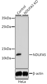 Western blot analysis of extracts from normal (control) and NDUFA5 knockout (KO) HeLa cells using NDUFA5 Polyclonal Antibody at dilution of 1:1000.