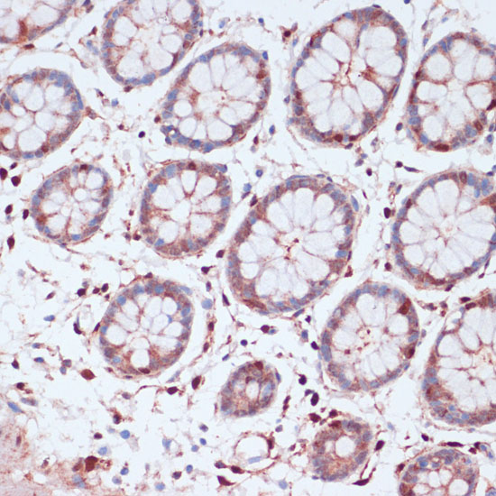 Immunohistochemistry of paraffin-embedded Human colon using S100A5 Polyclonal Antibody at dilution of  1:100 (40x lens).