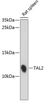 Western blot analysis of extracts of Rat spleen using TAL2 Polyclonal Antibody at dilution of 1:1000.