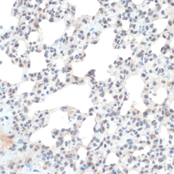 Immunohistochemistry of paraffin-embedded Rat lung using TXN Polyclonal Antibody at dilution of  1:100 (40x lens).