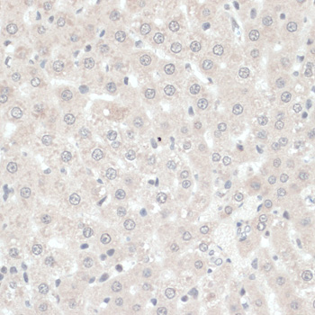 Immunohistochemistry of paraffin-embedded Rat liver using TXN Polyclonal Antibody at dilution of  1:100 (40x lens).