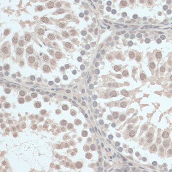 Immunohistochemistry of paraffin-embedded Rat testis using TXN Polyclonal Antibody at dilution of  1:100 (40x lens).