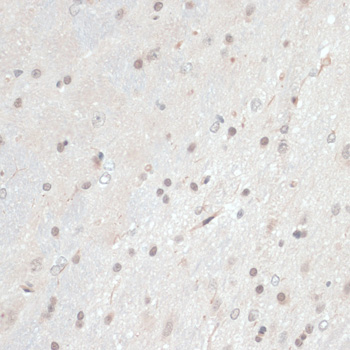 Immunohistochemistry of paraffin-embedded Rat brain using TXN Polyclonal Antibody at dilution of  1:100 (40x lens).