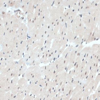 Immunohistochemistry of paraffin-embedded Rat heart using TXN Polyclonal Antibody at dilution of  1:100 (40x lens).