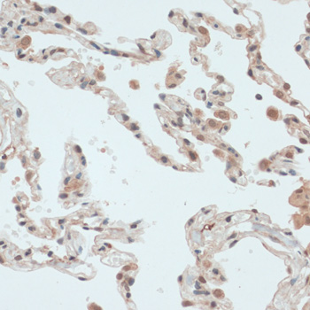 Immunohistochemistry of paraffin-embedded Human lung using TXN Polyclonal Antibody at dilution of  1:100 (40x lens).