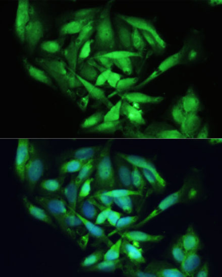 Immunofluorescence analysis of U2OS cells using XBP1 Polyclonal Antibody at dilution of  1:100. Blue: DAPI for nuclear staining.