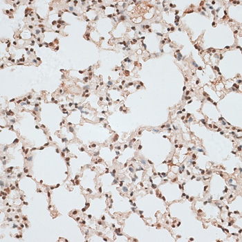 Immunohistochemistry of paraffin-embedded Mouse lung using ZNF141 Polyclonal Antibody at dilution of  1:100 (40x lens).