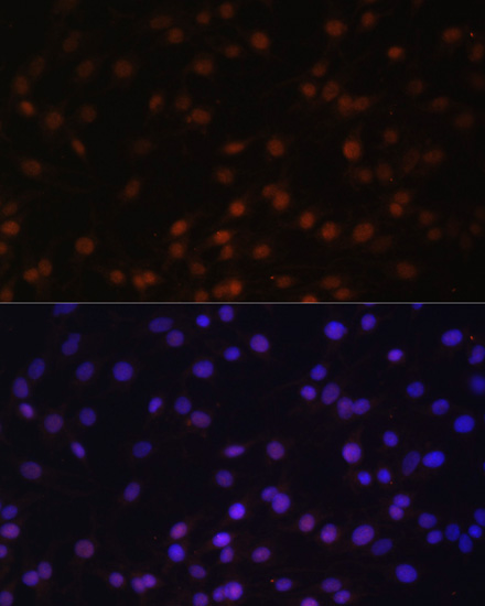 Immunofluorescence analysis of C6 cells using ZNF177 Polyclonal Antibody at dilution of  1:100. Blue: DAPI for nuclear staining.
