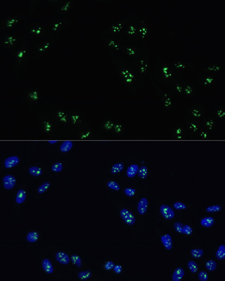 Immunofluorescence analysis of U-2 OS cells using DDX21 Polyclonal Antibody at dilution of  1:100. Blue: DAPI for nuclear staining.