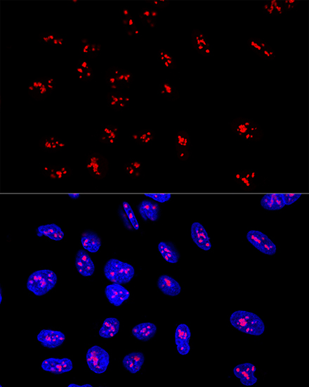 Confocal immunofluorescence analysis of U2OS cells using DDX21 Polyclonal Antibody at dilution of  1:100. Blue: DAPI for nuclear staining.