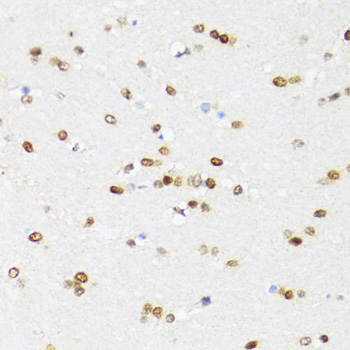 Immunohistochemistry of paraffin-embedded Mouse brain using DDX21 Polyclonal Antibody at dilution of  1:100 (40x lens).