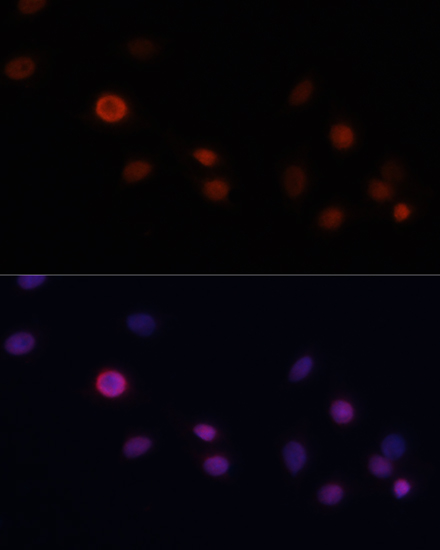 Immunofluorescence analysis of C6 cells using p21 Polyclonal Antibody at dilution of  1:100. Blue: DAPI for nuclear staining.