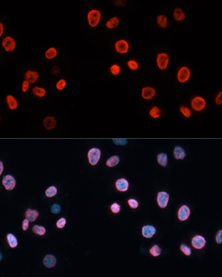 Immunofluorescence analysis of HeLa cells using p21 Polyclonal Antibody at dilution of  1:100. Blue: DAPI for nuclear staining.