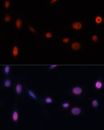 Immunofluorescence analysis of NIH/3T3 cells using p21 Polyclonal Antibody at dilution of  1:100. Blue: DAPI for nuclear staining.
