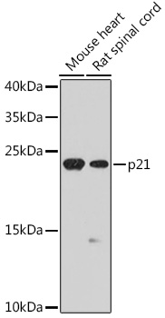 Western blot analysis of extracts of various cell lines using p21 Polyclonal Antibody at dilution of 1:1000.