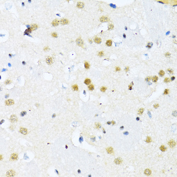 Immunohistochemistry of paraffin-embedded Mouse brain using ITGB3BP Polyclonal Antibody at dilution of  1:100 (40x lens).