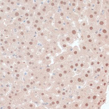 Immunohistochemistry of paraffin-embedded Mouse liver using ZNF562 Polyclonal Antibody at dilution of  1:100 (40x lens).