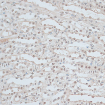 Immunohistochemistry of paraffin-embedded Mouse kidney using ZNF562 Polyclonal Antibody at dilution of  1:100 (40x lens).