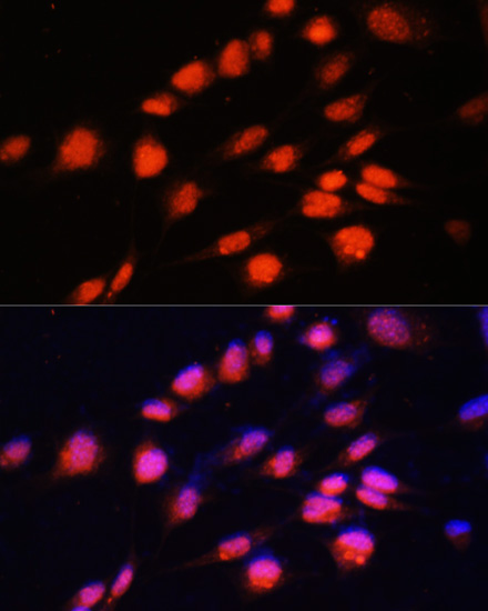 Immunofluorescence analysis of NIH-3T3 cells using ZNF416 Polyclonal Antibody at dilution of  1:100. Blue: DAPI for nuclear staining.