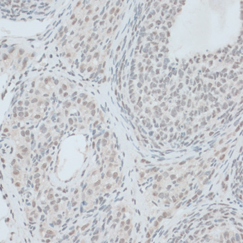 Immunohistochemistry of paraffin-embedded Rat ovary using ZNF416 Polyclonal Antibody at dilution of  1:100 (40x lens).