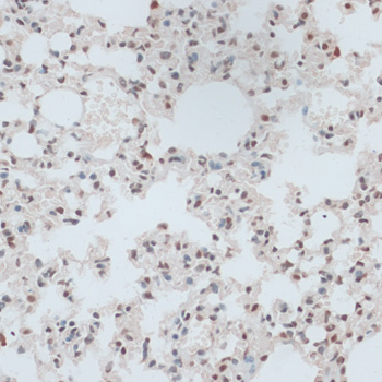 Immunohistochemistry of paraffin-embedded Mouse lung using ZNF416 Polyclonal Antibody at dilution of  1:100 (40x lens).